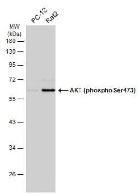 Western Blot: AKT [p Ser473] Antibody [NBP3-13120]